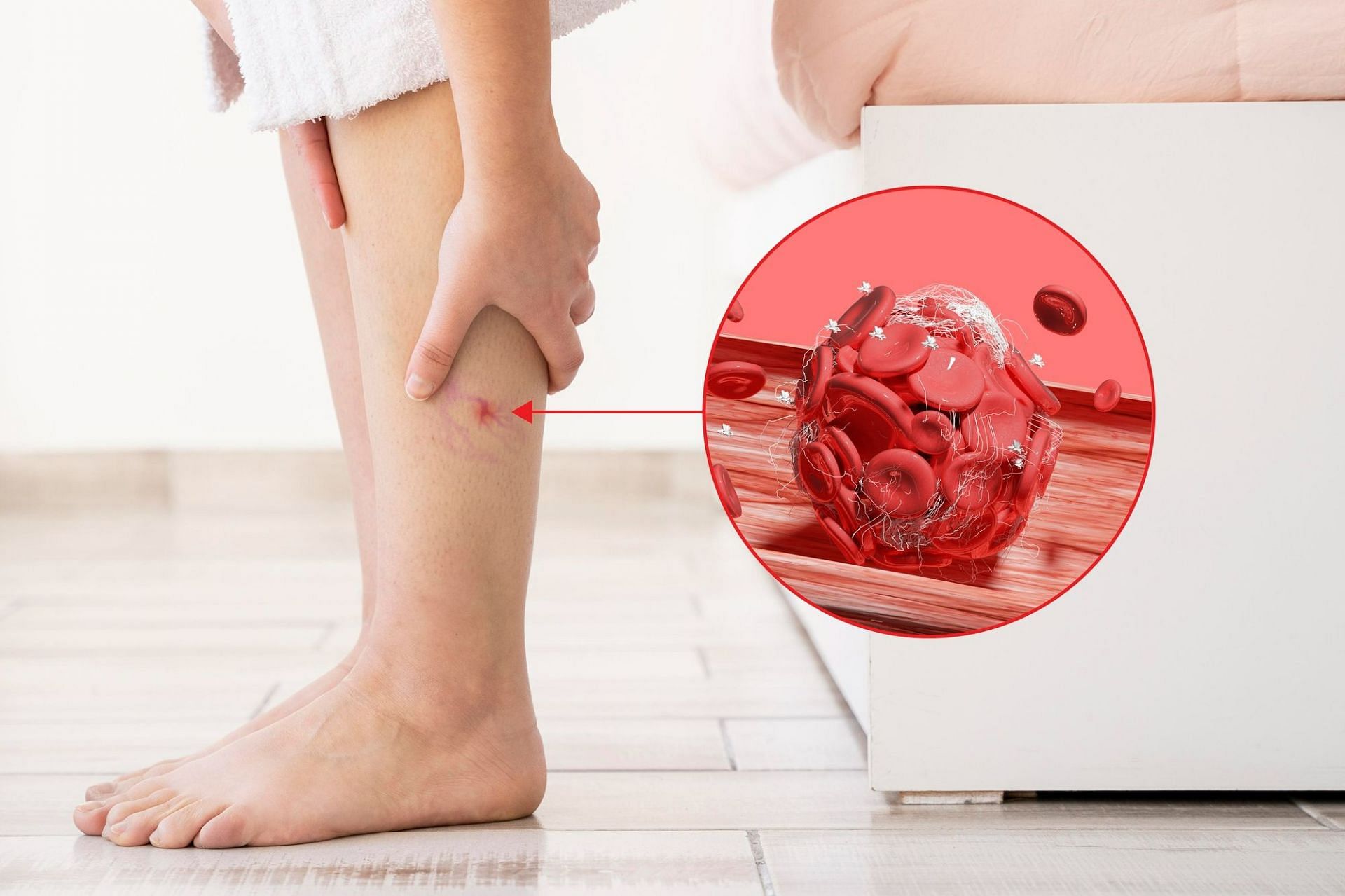 Blood clot in the leg (Image by Freepik on Freepik)